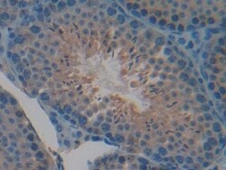 Invitrogen CYR61 Polyclonal Antibody 200 &mu;L; Unconjugated:Antibodies,