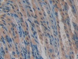 Invitrogen CYR61 Polyclonal Antibody 200 &mu;L; Unconjugated:Antibodies,