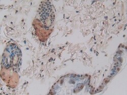 Invitrogen CYR61 Polyclonal Antibody 200 &mu;L; Unconjugated:Antibodies,