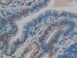 Invitrogen CYR61 Polyclonal Antibody 200 &mu;L; Unconjugated:Antibodies,
