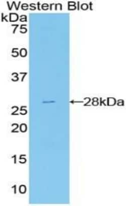 Invitrogen&trade;&nbsp;FRS2 Polyclonal Antibody