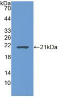 Invitrogen UBE2L3 Polyclonal Antibody 200 &mu;L; Unconjugated:Antibodies,