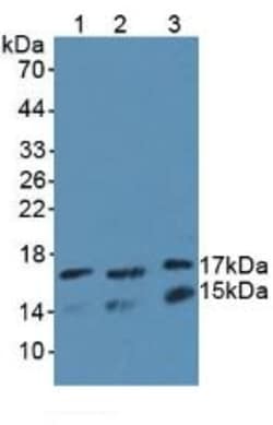 Invitrogen&trade;&nbsp;UBE2L3 Polyclonal Antibody