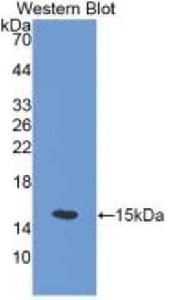 Invitrogen SLC30A5 Polyclonal Antibody 200 &mu;L | Buy Online | Invitrogen&trade; | Fisher Scientific