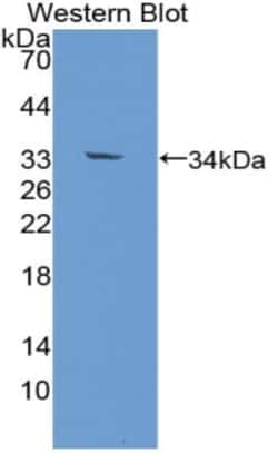 Invitrogen&trade;&nbsp;EBF1 Polyclonal Antibody