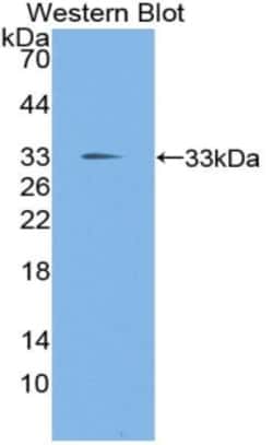 Invitrogen&trade;&nbsp;KLF10 Polyclonal Antibody