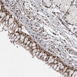 Invitrogen Cdc27 Polyclonal Antibody 100 &mu;L | Buy Online | Invitrogen&trade; | Fisher Scientific