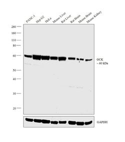 Invitrogen GCK Polyclonal Antibody 200 μL; Unconjugated:Antibodies,