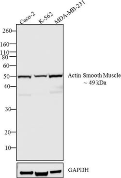 Alpha-Smooth Muscle Actin Polyclonal Antibody, Invitrogen 500 &mu;L; Unconjugated:Antibodies,
