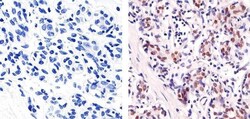 Ki-67 Polyclonal Antibody, Invitrogen 500 &mu;L; Unconjugated:Antibodies,