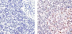 Ki-67 Polyclonal Antibody, Invitrogen 500 &mu;L; Unconjugated:Antibodies,