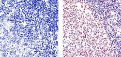 Ki-67 Polyclonal Antibody, Invitrogen 500 &mu;L; Unconjugated:Antibodies,