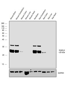 PGP9.5 Polyclonal Antibody, Invitrogen 500 &mu;L; Unconjugated:Anticuerpos
