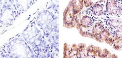 Claudin 3 Polyclonal Antibody, Invitrogen 500 &mu;L; Unconjugated:Antibodies,
