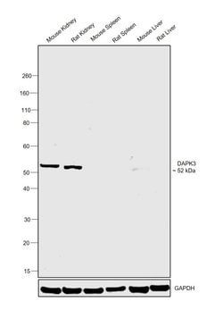 Invitrogen ZIPK Polyclonal Antibody 100 &mu;L; Unconjugated:Antibodies,