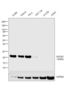 Invitrogen SOCS2 Polyclonal Antibody 100 &mu;L; Unconjugated:Antibodies,