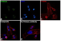 DYRK1A Polyclonal Antibody:Antibodies, Polyclonal
