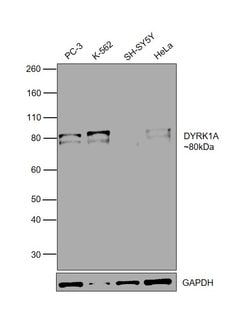 DYRK1A Polyclonal Antibody:Antibodies, Polyclonal