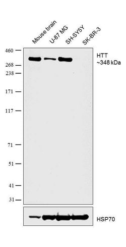 Huntingtin Polyclonal Antibody, Invitrogen 100 &mu;L; Unconjugated:Antibodies,