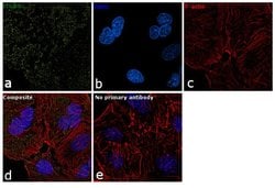 Invitrogen ITGB5 Polyclonal Antibody 100 μL; Unconjugated:Antibodies,