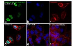 Invitrogen Acetyl-NFkB p65 (Lys310) Polyclonal Antibody 100 &mu;L; Unconjugated:Antibodies,