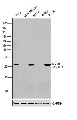 Invitrogen MGMT Polyclonal Antibody 100 &mu;L; Unconjugated:Antibodies,