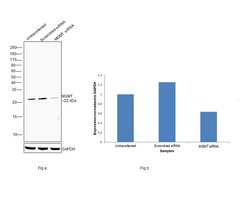 Invitrogen MGMT Polyclonal Antibody 100 &mu;L; Unconjugated:Antibodies,