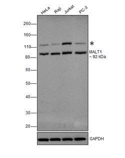 MALT1 Polyclonal Antibody, Invitrogen 100 &mu;L; Unconjugated:Antibodies,