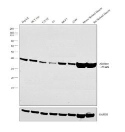 Invitrogen Aldolase A Polyclonal Antibody 100 &mu;L; Unconjugated:Antibodies,