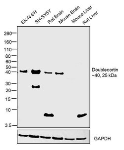 Invitrogen Doublecortin Polyclonal Antibody 100 &mu;L; Unconjugated:Antibodies,