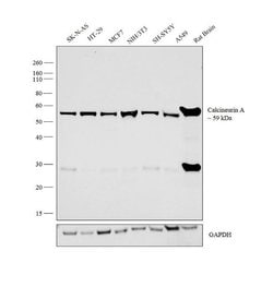 Invitrogen Calcineurin A Polyclonal Antibody 100 &mu;L; Unconjugated:Antibodies,