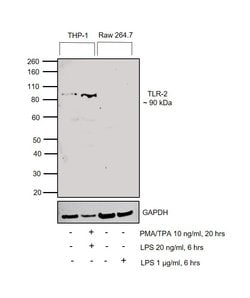 Invitrogen TLR2 Polyclonal Antibody 100 &mu;L; Unconjugated:Antibodies,