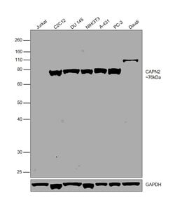 Invitrogen Calpain 2 Polyclonal Antibody 100 &mu;L | Buy Online | Invitrogen&trade; | Fisher Scientific