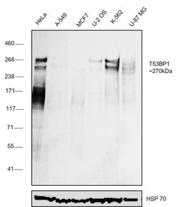 Invitrogen 53BP1 Polyclonal Antibody 100 &mu;L; Unconjugated:Antibodies,