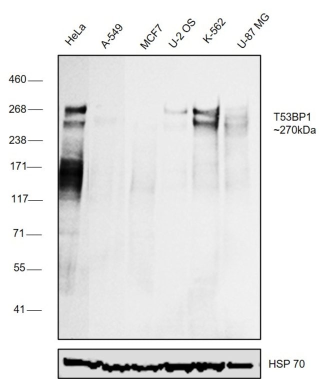 53BP1 Polyclonal Antibody, Invitrogen 100 μL; Unconjugated
