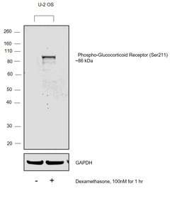 Invitrogen Phospho-Glucocorticoid Receptor (Ser211) Polyclonal Antibody 100 &mu;L | Buy Online | Invitrogen&trade; | Fisher Scientific