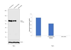 Invitrogen ERK5 Polyclonal Antibody 100 &mu;L; Unconjugated:Antibodies,