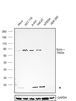 Invitrogen Ezrin Polyclonal Antibody 100 &mu;L | Buy Online | Invitrogen&trade; | Fisher Scientific