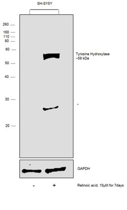 Invitrogen Tyrosine Hydroxylase Polyclonal Antibody 100 &mu;L; Unconjugated:Antibodies,
