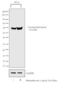 Invitrogen Tyrosine Hydroxylase Polyclonal Antibody 100 &mu;L; Unconjugated:Antibodies,