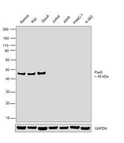 Invitrogen PAX5 Polyclonal Antibody 100 &mu;g; Unconjugated:Antibodies,