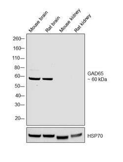 Invitrogen GAD65 Polyclonal Antibody 100 &mu;g; Unconjugated:Antibodies,