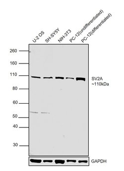 Invitrogen SV2A Polyclonal Antibody 100 &mu;g; Unconjugated:Antibodies,