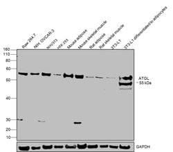 Invitrogen ATGL Polyclonal Antibody 100 &mu;g; Unconjugated:Antibodies,