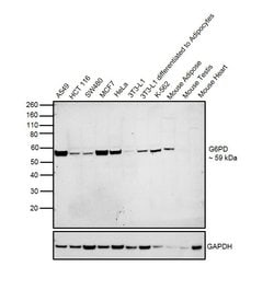 G6PD Polyclonal Antibody:Antibodies, Polyclonal