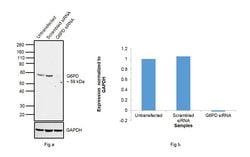 G6PD Polyclonal Antibody:Antibodies, Polyclonal