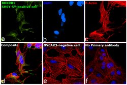 Invitrogen B1 Bradykinin Receptor Polyclonal Antibody 100 &mu;g; Unconjugated:Antibodies,