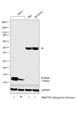 Invitrogen S100A9 Polyclonal Antibody 100 &mu;g; Unconjugated:Antibodies