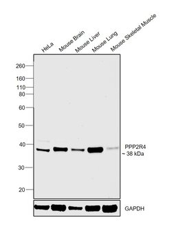 Invitrogen PPP2R4 Polyclonal Antibody 100 &mu;g; Unconjugated:Anticuerpos