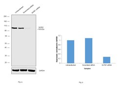 Invitrogen SATB1 Polyclonal Antibody 100 &mu;g; Unconjugated:Antibodies,